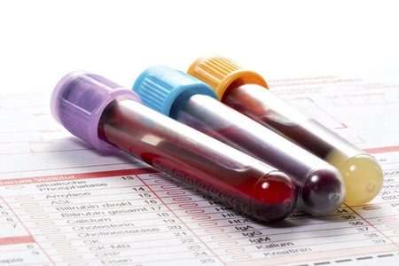 Blood test tubes on laboratory results form for functional medicine lab testing